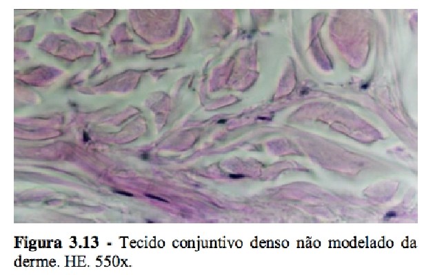 Tecido Denso Não Modelado Fibras colágenas dispostas pelos fibroblastos em diferentes direções, dando ao tecido resistência às