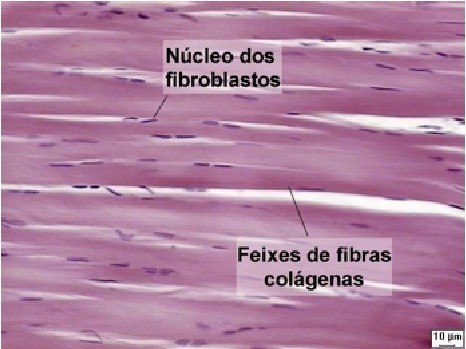 Tecido Denso Modelado Fibras colágenas estão paralelas, organizadas pelos fibroblastos em resposta à tração