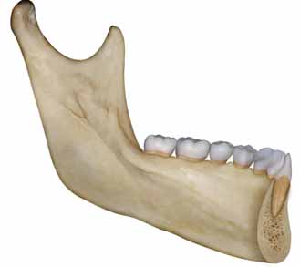 58 Ortodontia - Cabrera & Cabrera Mais frequentemente encontradas nos indivíduos dolicofacias. Manifestam-se alta verticalmente e estreita horizontalmente, com pogônio discreto ou ausente.