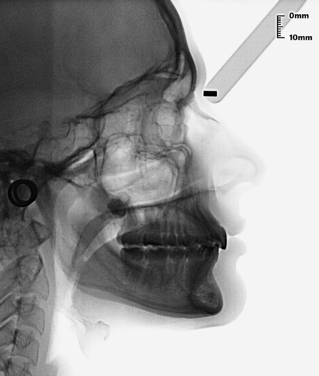 Zanelato R Figura 68: Telerradiografia