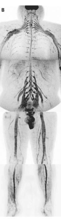 Whole-Body Magnetic Resonance Neurography Yamashita T, M.D.