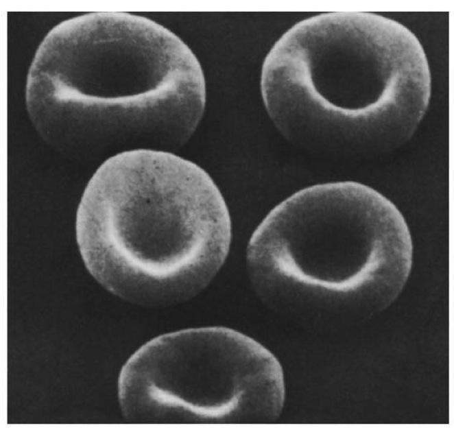 HERITRÓCITOS (HEMÁCIAS) Anucleados (no homem; nucleados outros mamíferos Forma bicôncava aumenta proporção área / volume - facilita troca de gases Flexível se adapta à forma dos capilares Contém