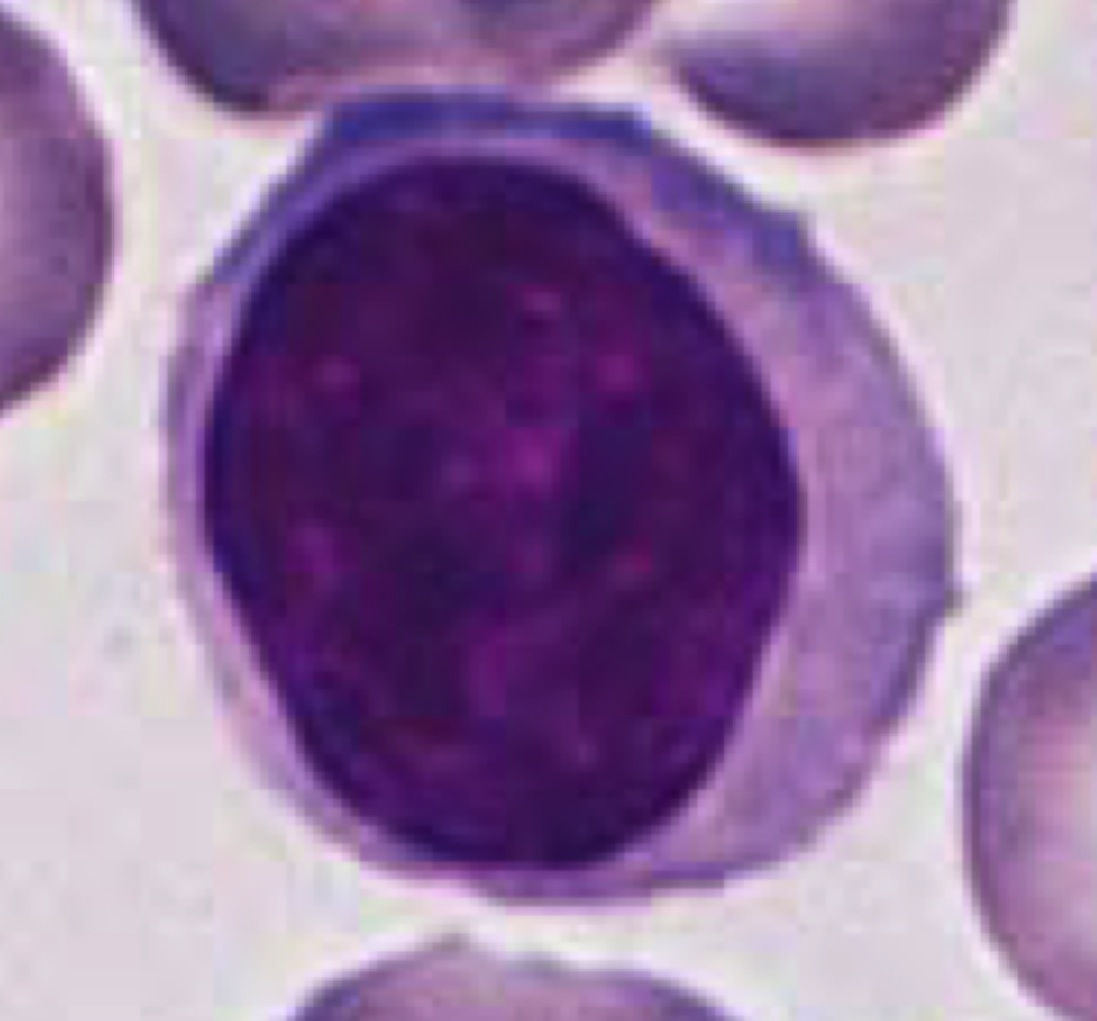 LINFÓCITOS - Principais células do sistema imune - Núcleo esférico e escuro que ocupa quase todo
