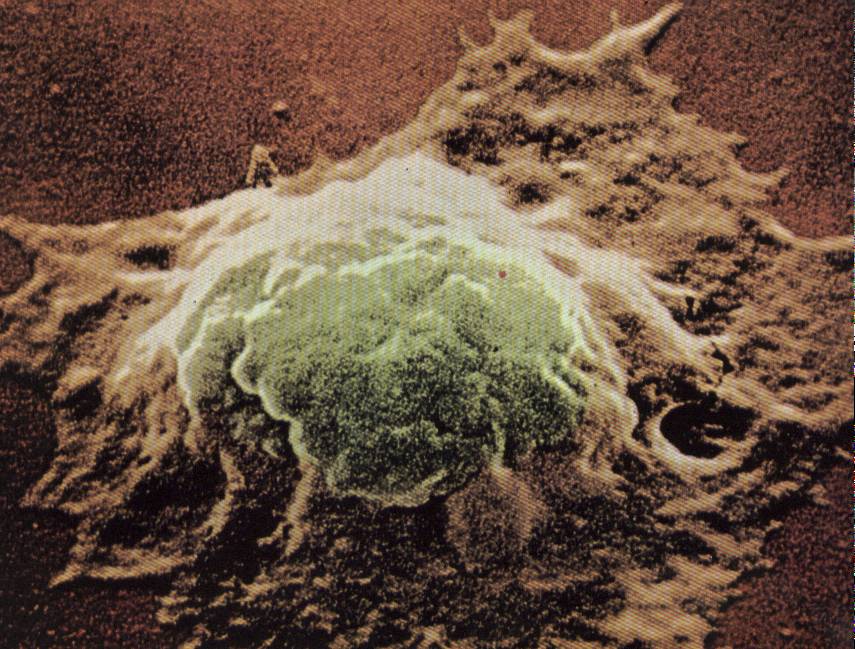 Sistema Mononuclear Fagocitário Macrófago Célula de Kupffer (fígado)