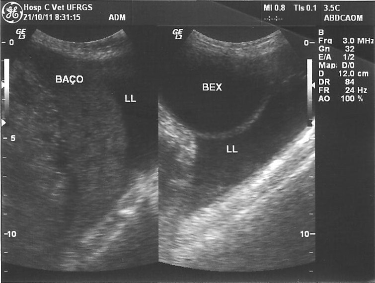 Caso clínico 2011/2/05 página 6 FIGURAS Figura 1. Ecografia abdominal com ênfase no fígado e na vesícula biliar. Fígado com contorno irregular, parênquima hipoecogênico, heterogêneo.