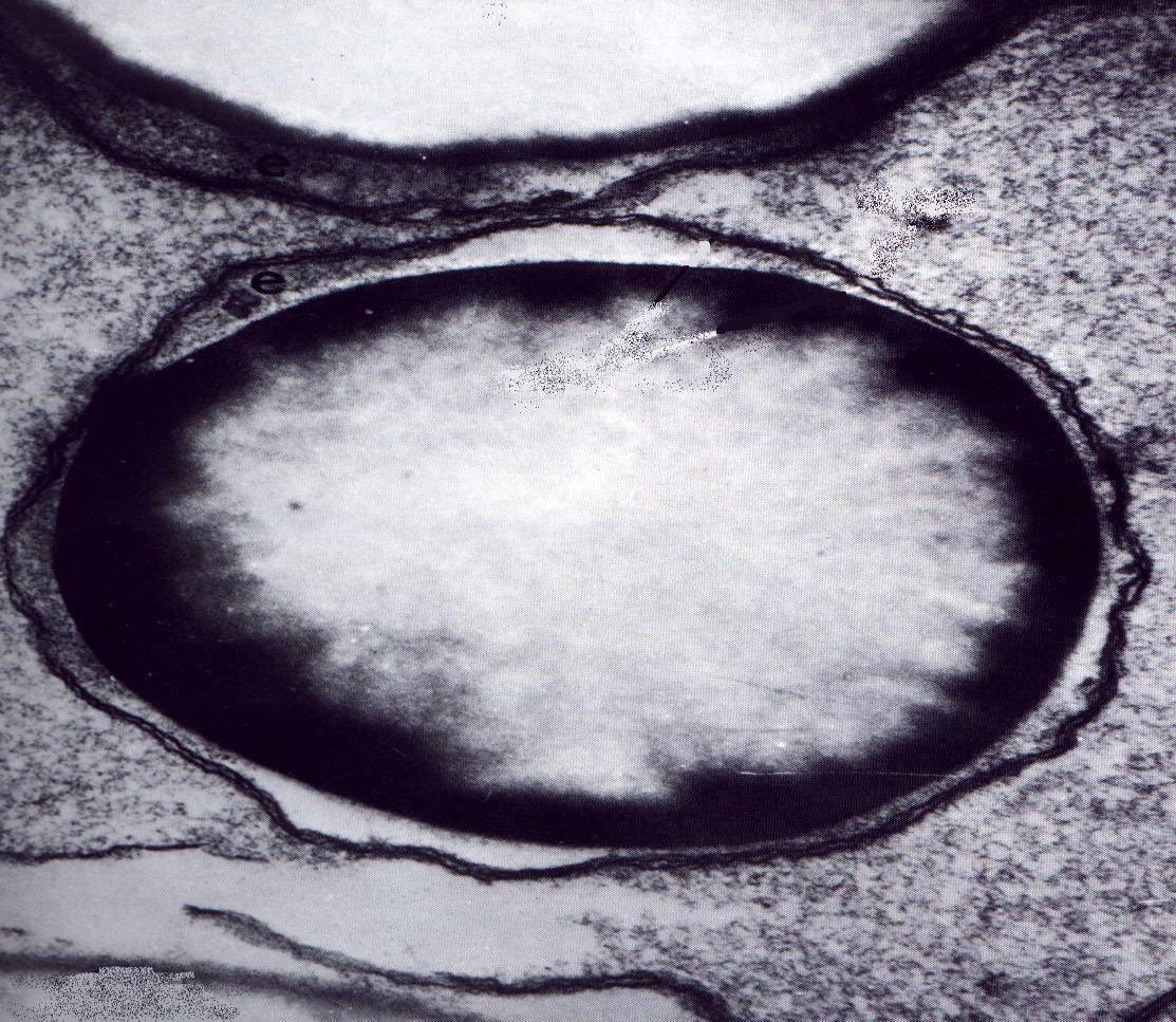 O amiloplasto, acumula amido em tecidos de reserva.
