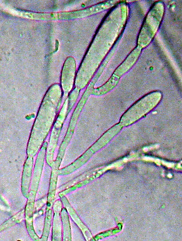 6/11/212 FUSARIOSE - Fusarium oxysporum f. sp. herbemontis Murcha vascular FUSARIOSE - Fusarium oxysporum f. sp. herbemontis Murcha vascular Manejo 1. 2. 3. 4. 5. 6. 7. 8.