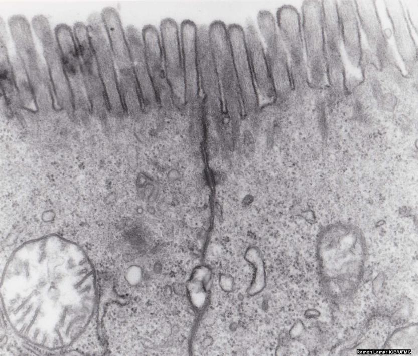 Microvilosidades projeção da membrana celular - digitiformes