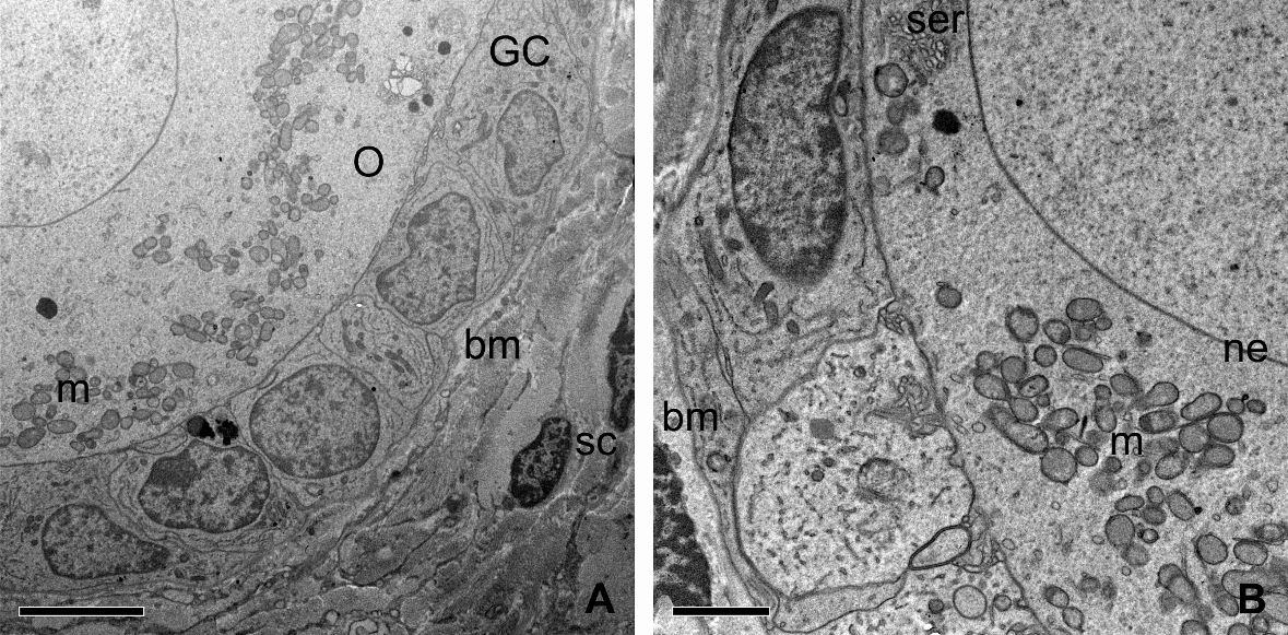 70 Fig. 4. Electron micrographs of normal follicles from control group (A) and stored in MEM at 4 C for 12 h (B).