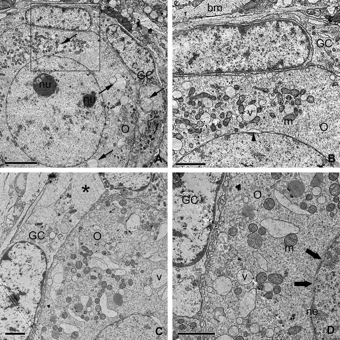 72 Fig. 6. Electron micrographs of follicles stored in saline solution at 4 C for 24 h.