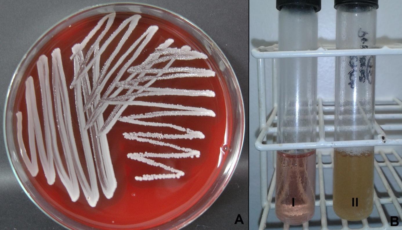 8 Figura 2: A Crescimento bacteriano em placa de Petri contendo Ágar Sangue verificado após 24h em estufa a 37 C; B I Caldo Tioglicolato límpido; II- Caldo Tioglicolato turvo com presença de