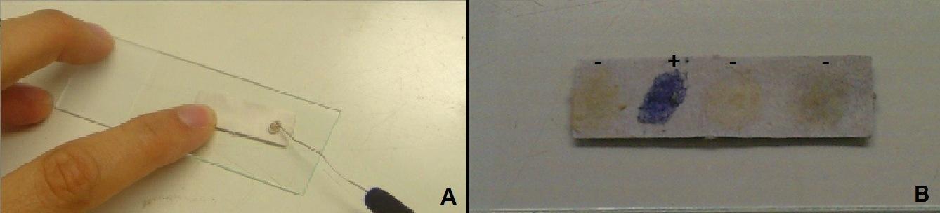 13 Figura 5:A - Realização do teste de oxidase; B - Teste da oxidase positivo e negativos. Fonte: Cedido por Msc. Hudson Holanda. 5.5. TESTE DA OXIDAÇÃO/FERMENTAÇÃO DA GLICOSE O teste da oxidação/fermentação da glicose(o/f) em meio Ágar Hugh & Leifson permite determinar o uso da via oxidativa ou fermentativa da glicose.