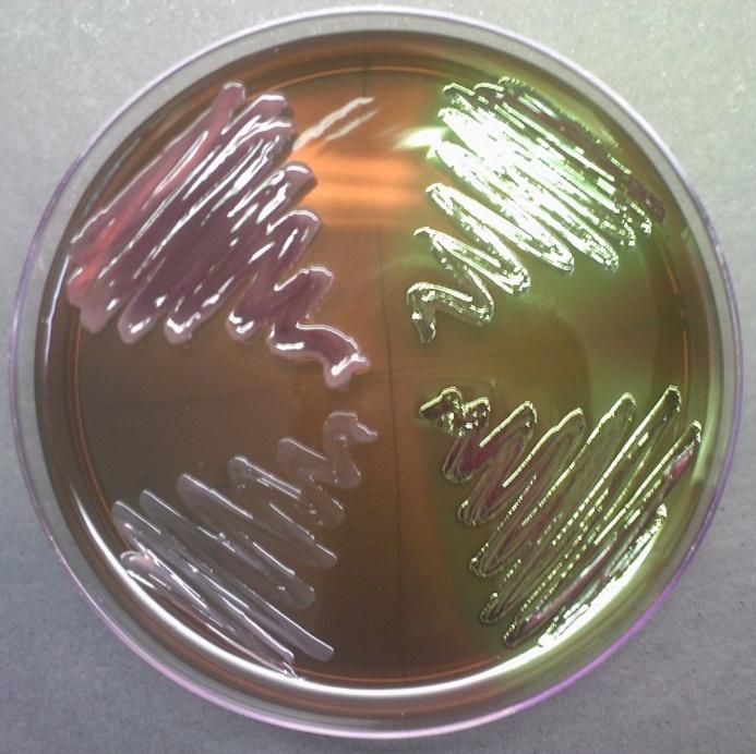 18 de Escherichia coli, pois neste meio, esta enterobactéria apresenta característica única, possui um brilho verde-metálico, como evidenciado na Figura 9 (Quinn et al.,1994; Quinn et al.
