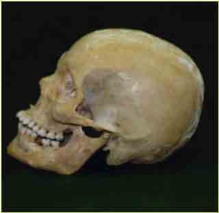 24 A ATM é formada pelo côndilo mandibular que se articula na fossa mandibular do osso temporal ( Figura 2.2). Separando esses dois ossos para que não se articulem diretamente está o disco articular.
