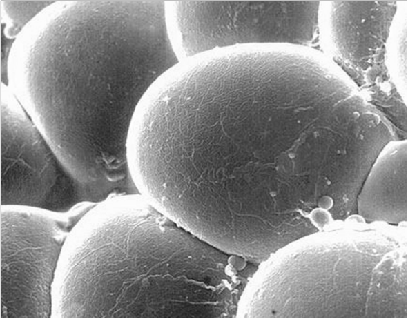 O tecido adiposo como glândula Adiponectina TNF-α Resistina Leptina IL-6 ASP Plasminogenio Principais adipocinas produzidas pelo tecido adiposo Adipocina Adiponectina Angiotensinogênio ASP IL-6