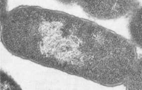 Cápsula Periplasma Citoplasma: 1. Cromossoma (nucleóide) 2. Ribossoma 3. Corpúsculos de inclusão 4. Vacúolos gasosos citoplasmática Estrutura delgada que envolve à célula.