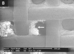 FIGURA 4: Braquete antes (A) e após (B) o jateamento, observado no Microscópio Eletrônico de Varredura. Verifica-se a presença de resina remanescente em maior quantidade nas bordas (setas).