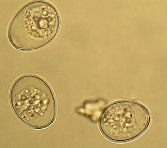 Coccidiose em Bezerros Etiologia Coccídeos do Gênero Eimeria Eimeria