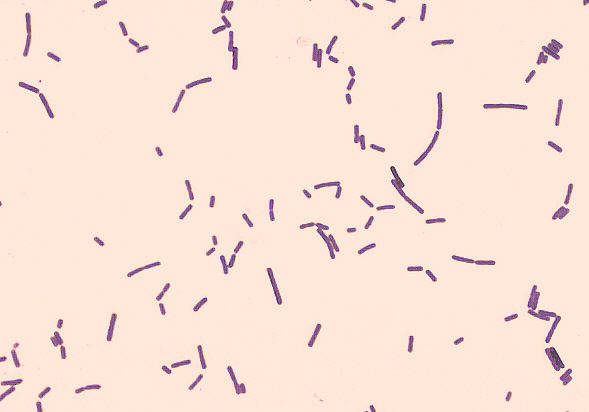 Bacillus anthracis Corynebacterium diphteriae Concentração não deve ser excessiva Aguardar secagem total do esfregaço Fixação pelo calor Evitar que os micro-organismos sejam perdidos durante as