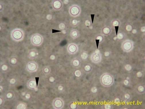 Cryptococcus neoformans Nanquim Nigrosina Coloração diferencial Utilização de dois corantes contrastantes, gerando duas colorações