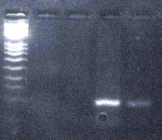 Aquicella lusitana e Aquicella siphonis Algumas coisas não são aquilo que parecem 1 2 3 4 5 mip gene 1 2 3 4 5 6 7 dota gene 2642 bp 500 bp 697 bp 1- Marker 2- Sgt 39 (Aquicella) 3-