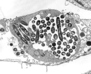 Identificação presumptiva Visualização das colónias suspeitas Norma ISO 11731 Identificação presumptiva de Legionella