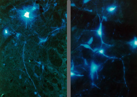 Nível das células corticais Neurónios Piramidais Camada V Espinhas dendríticas Axónio vertical