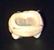 Válvula de Pericárdio Bovino A válvula de pericárdio bovino é constituída por três lascíneas fixadas em uma parede de material sintético e um anel de sutura utilizado para sua fixação.