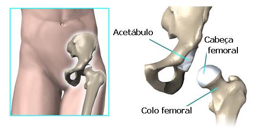 A Anatomia do quadril O quadril é uma articulação semelhante a uma bola no pegador de sorvete, onde a cabeça femoral (esférica) é o sorvete e o acetábulo (em forma de taça) é o pegador.