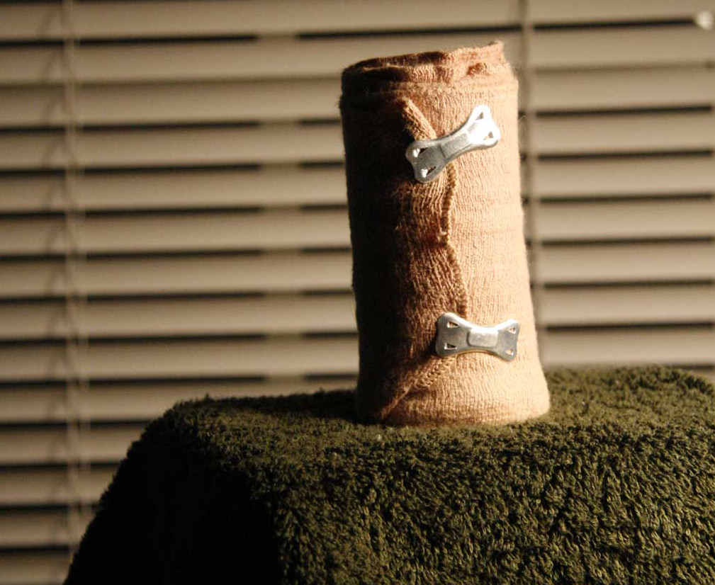 Ivy Dawned Fonte: http://www.flickr.com/photos/ivydawned/2842040482/ Figura 6.2: Ataduras protegidas por algodão ortopédico são utilizadas na contenção de pacientes agressivos.