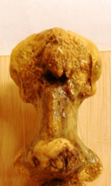 Esterno O esterno (osso do peito) é um osso segmentado mediano que completa o esqueleto do tórax ventralmente e articula-se com as cartilagens das costelas esternais lateralmente.