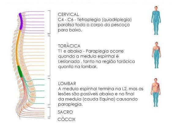 Fig. 5 - Anatomia da coluna e possíveis níveis de lesões Fonte: http://www.vidasobre4rodas.com.br/wp-content/uploads/2015/07/niveis-de-lesoes-dacoluna.