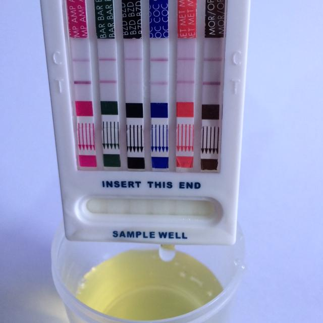 APLICAÇÃO DO TESTE PELO MÉTODO MERGULHO (URINA) Passo 11: retirar o cassete da amostra de urina. Obs.