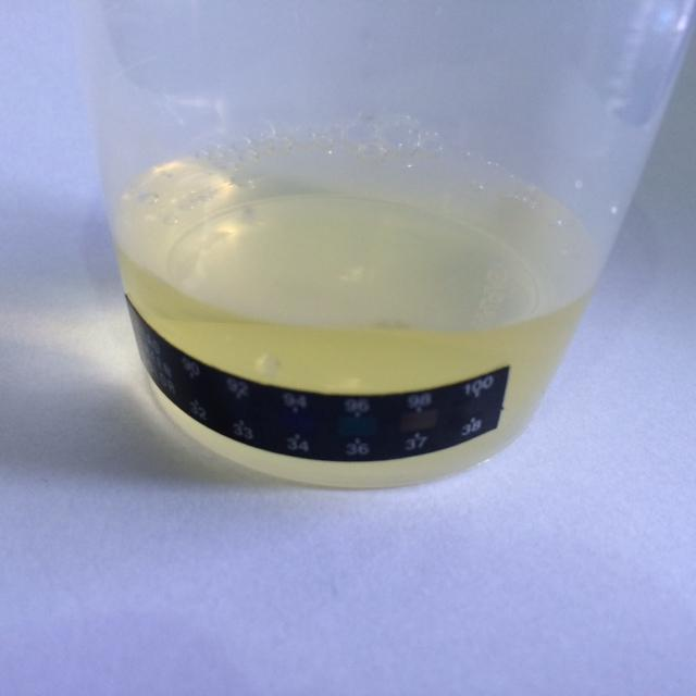 APLICAÇÃO DO TESTE PELO MÉTODO CONTA-GOTAS (URINA) Passo 3: coletar a urina do doador, utilizar o copo coletor.