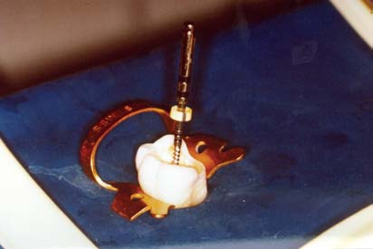 O sentido da hélice é à esquerda e os dentes de corte são igualmente espaçados ao redor da haste metálica (120º).