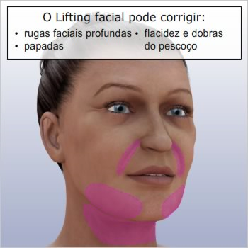 Lifting facial do terço inferior Introdução A identidade humana é determinada primeiramente pelo rosto sua estrutura, aparência e expressões.