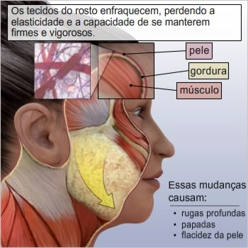 Anatomia facial Antes de saber como funciona um lifting facial, ou ritidoplastia, é importante conhecer a estrutura do rosto e entender como o processo de envelhecimento provoca mudanças ao longo do