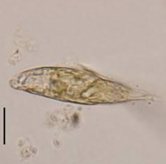 Cyanophyceae Aphanocapsa delicatissima Merismopedia tenuissima Microcystis aeroginosa Chroococcus sp. Dolichospermum sp.
