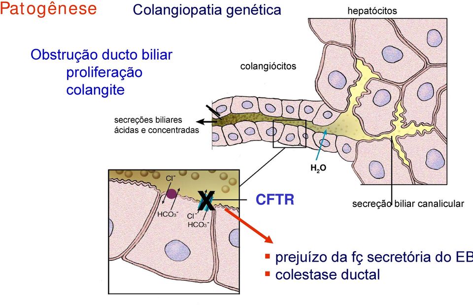 secreções biliares ácidas e concentradas H 2 O CFTR