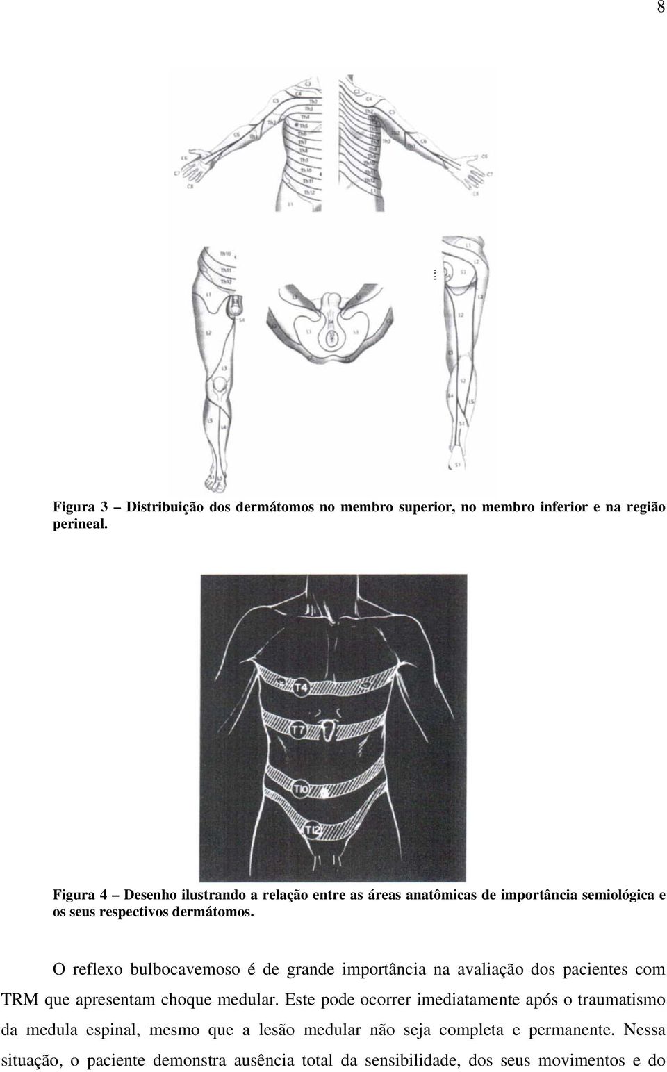 O reflexo bulbocavemoso é de grande importância na avaliação dos pacientes com TRM que apresentam choque medular.