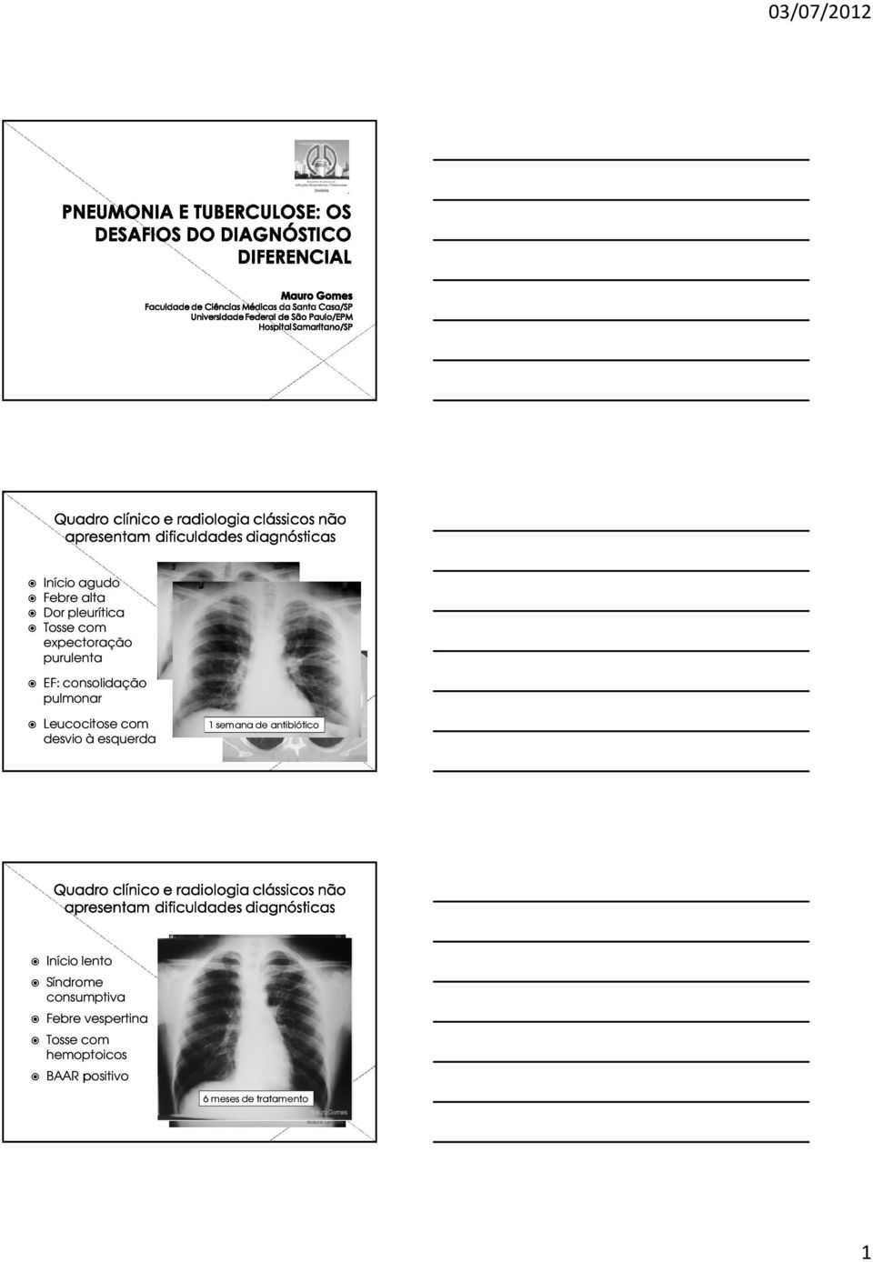 esquerda 1 semana de antibiótico Início lento Síndrome consumptiva