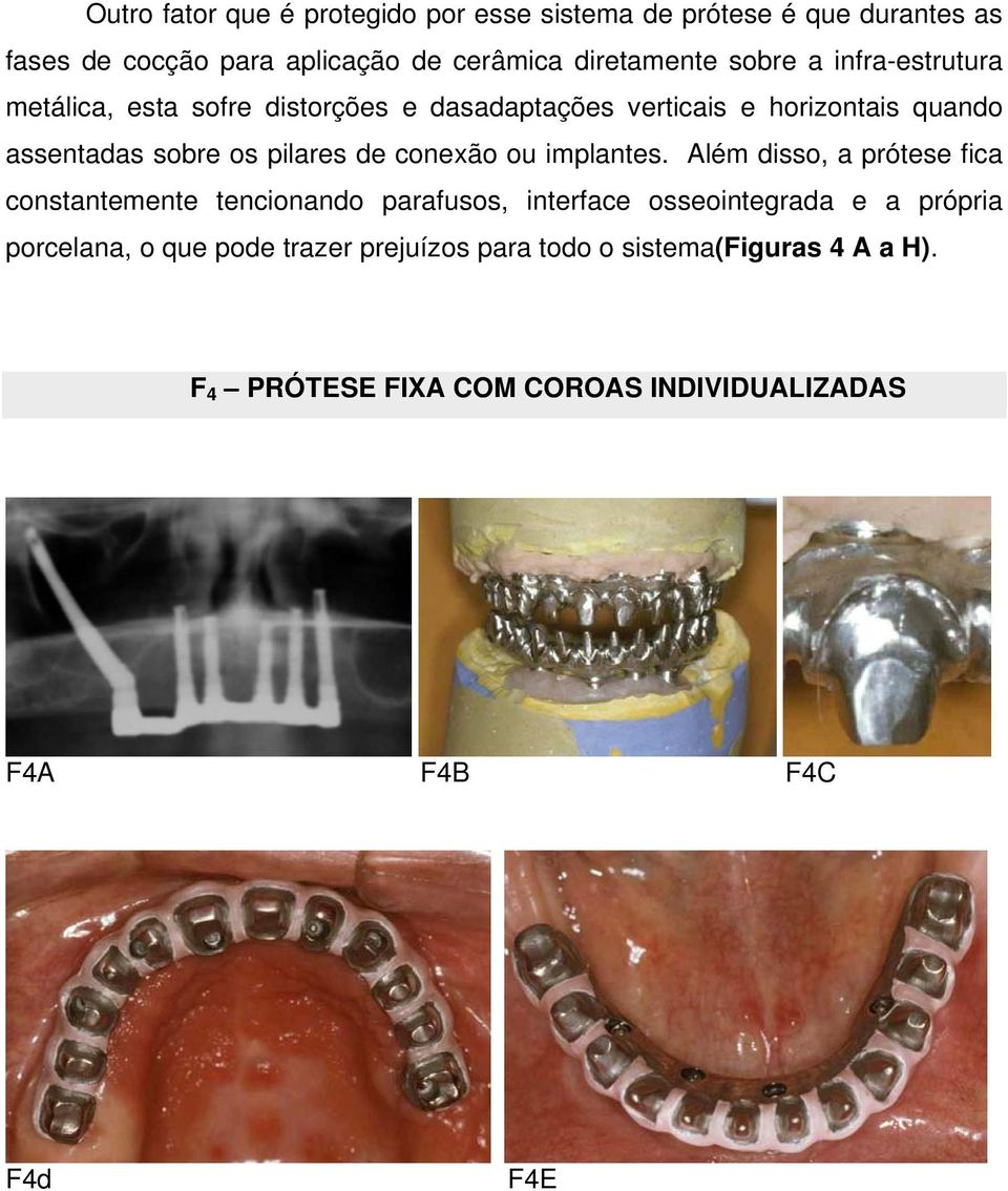 de conexão ou implantes.