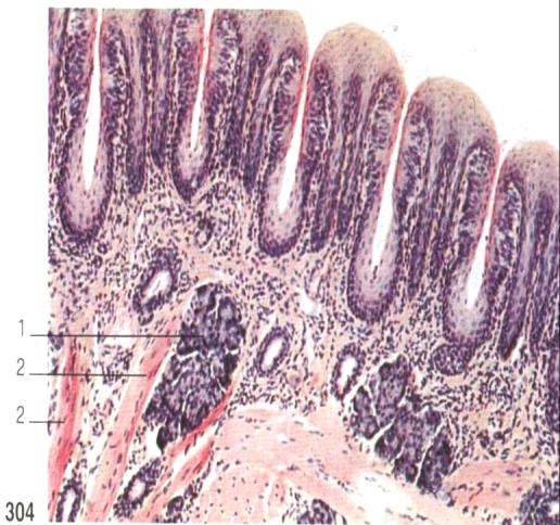 papila fungiforme papila