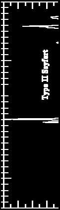 Modelo Unificado de AGNs AGN são galáxias de núcleo ativo.