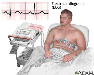 Electrocardiograma (ECG) Registo da actividade