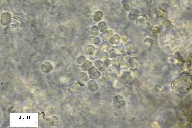 157 (a) Bacilos (b) Bacilos coloniais (c) Bacilos curvos (d) Methanosaeta sp. (e) Methanosarcina sp. Figura 5.