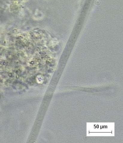 160 (g) Flagelado (h) Paramecium (i) Rotífero (j) Thiotrix Figura 5.