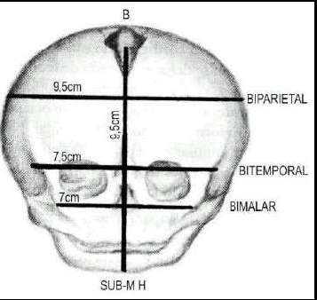 Suturas e fontanelas Diâmetros ântero-posteriores diâmetros transversos e