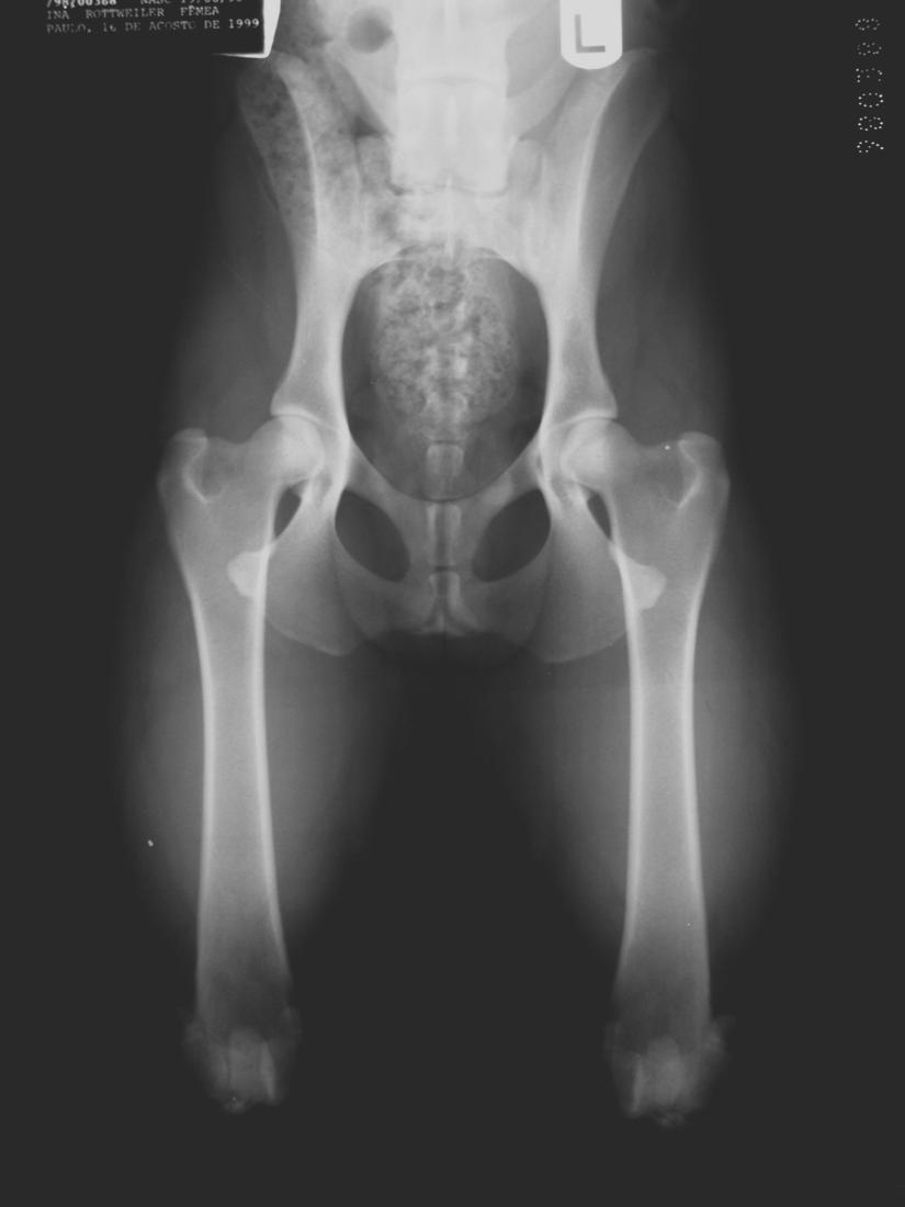 6. Qualidade da imagem radiográfica: A qualidade da imagem radiográfica será verificada ao se observar que a mesma oferece condições para avaliação da trabeculação óssea das cabeças e colos femorais