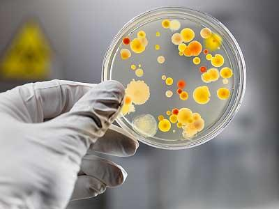 Onde isolar? Meios de cultura: Material nutriente preparado no laboratório para o crescimento de microrganismos.